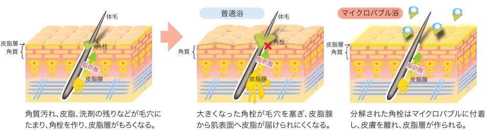 皮膚表面に微細な泡が入り、汚れとともに離れるイメージ図